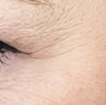 Collagen
Loss Starts