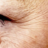 Visible Aging
Sets In