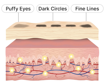 Collagen Replenishment