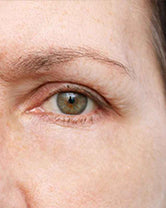 After — Lauren M., 47 · Charlotte, NC