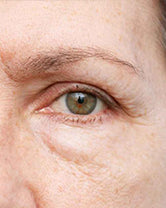 Before — Lauren M., 47 · Charlotte, NC
