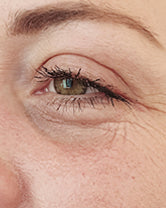 Before — Patricia D., 44 · Tampa, FL