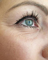 Before — Susan R., 49 · Portland, OR